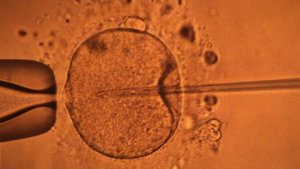 Image représentant la micro-injection par pipette d'un spermatozoïde dans un ovocyte, au Centre d'étude et de conservation des oeufs et du sperme&nbsp;(CECOS) de Rennes (Ille-et-Vilaine).&nbsp; (MARCEL MOCHET / AFP)