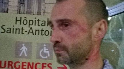 Julien Pontes, pr&eacute;sident du Paris Foot Gay, apr&egrave;s son agression &agrave; Paris, le 26 juillet 2015. (PARIS FOOT GAY)