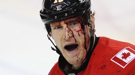 Le joueur de hockey sur glace des Calgary Flames Tim Jackman apr&egrave;s son altercation avec un joueur du Minnesota Wild en match de la NHL &agrave; Calgary (Canada), le 20 d&eacute;cembre 2011. (TODD KOROL / REUTERS)