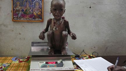 Une petite fille de 2 ans souffrant de malnutrition est pes&eacute;e dans un centre de soin &agrave; Madhya (Inde), le 1er f&eacute;vrier&nbsp;2012. (ADNAN ABIDI / REUTERS)