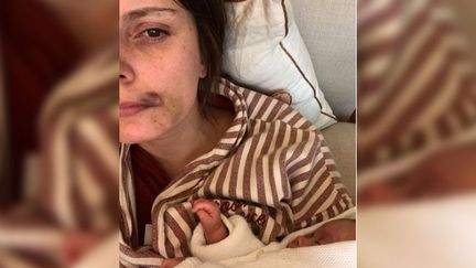 Amélie Challeat le visage tuméfié tenant sa fille dans les bras dans un post Instagram publié samedi 13 février&nbsp;2021. (CAPTURE D'ECRAN INSTAGRAM)