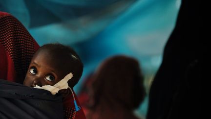 Shiniyo, 2 ans, est soign&eacute;e dans un h&ocirc;pital M&eacute;decins sans fronti&egrave;res du camp de r&eacute;fugi&eacute;s de Dadaab (Kenya), le 4 juillet 2011. (ROBERTO SCHMIDT / AFP)