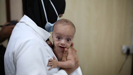 Un bébé syrien, souffrant de malnutrition, dans les bras d'une médecin, dans un hôpital de Damas, le 14 octobre 2017. (AMER ALMOHIBANY / ANADOLU AGENCY)