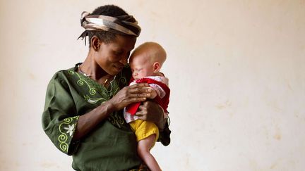 Une m&egrave;re tient son enfant albinos, en Tanzanie, dans un centre de protection, le 3 ao&ucirc;t 2012. (JACQUELYN MARTIN / AP / SIPA)