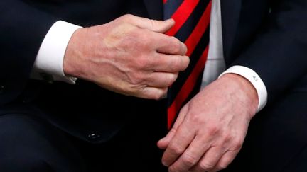 L'empreinte du pouce d'Emmanuel Macron sur la main droite de Donald Trump, après leur rencontre au G7 vendredi 8 juin, à&nbsp;La Malbaie, au Québec. (LEAH MILLIS / X90205)