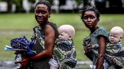 Le président tanzanien promet de mieux protéger les albinos (BUNYAMIN AYGUN / MILLIYET DAILY / AFP)