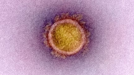 Une image du Sars-CoV-2, le virus à l'origine du Covid-19, au microscope, en avril 2020. (NIAID-NIH / PHANIE / AFP)