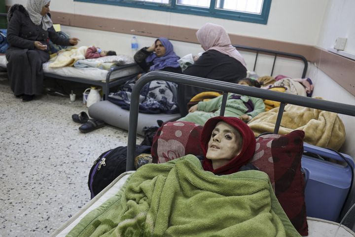 Yazan al-Kafarneh, 10 ans, à l'hôpital al-Awda à Rafah, le 29 février 2024. (AFP)