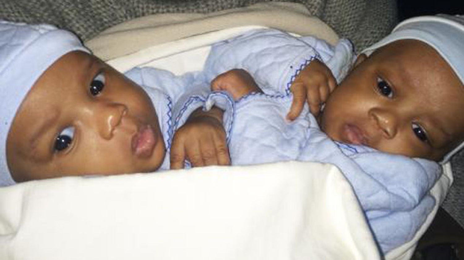 Des Bebes Siamois Separes Avec Succes A L Hopital Parisien Necker