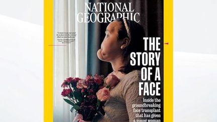 National Geographic consacre son numéro de septembre à l'histoire de la jeune Katie Stubblefield