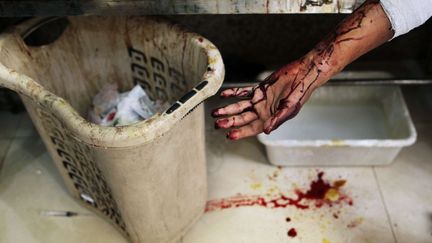 Un homme victime d'un bombardement de l'arm&eacute;e syrienne est soign&eacute; &agrave; Alep (Syrie), en septembre 2012. (MUHAMMED MUHEISEN / SIPA / AP)