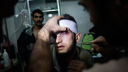 Soins d’urgences pour un homme blessé aux yeux. (AFP PHOTO / FABIO BUCCIARELLI)