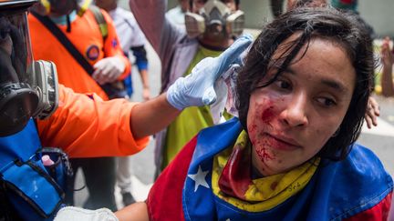 Une jeune femme blessée dans une manifestation au Venezuela le 21 novembre 2018. (MIGUEL GUTI?RREZ / EFE)