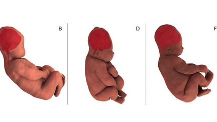 Déformations du crâne du bébé lors de l'accouchement : précieux indices de leur état de santé ? (Cr&eacute;dits Photo : &copy; PLOS ONE, Ami et al. 2019)