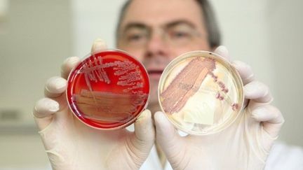 Le directeur de l'Institut allemand de Kiel, Helmut Fickenscher, présente des cultures de bactéries Escherichia coli (AFP / PHOTO BODO MARKS GERMANY OUT)