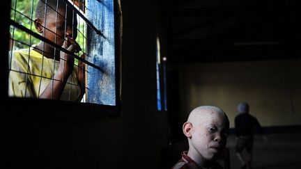 Les albinos vivent dans la terreur. Le prix payé pour leur sang ou un de leurs membres peut atteindre 2000 euros. Le petit frère d'Amani a été tué et mutilé en février 2008. Il avait 5 ans. (AFP PHOTO / TONY KARUMBA)