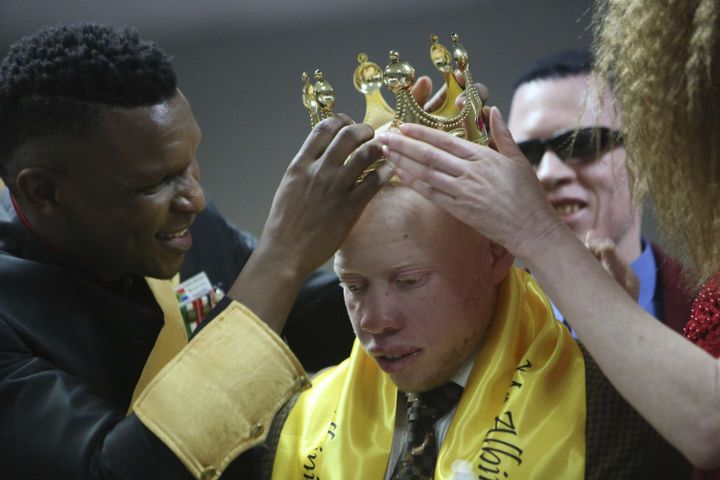 Edson Mambinge, couronné Mister Albinos 2019, lors d'un concours organisé à Harare au Zimbabwe le 25 mai 2019. (TSVANGIRAYI MUKWAZHI/AP/SIPA / AP)