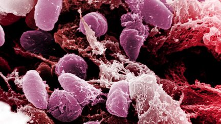 La bact&eacute;rie "Yersinia pestis", responsable de la peste bubonique, vue au microscope &eacute;lectronique. (NIAID-NIH / PHANIE / AFP)