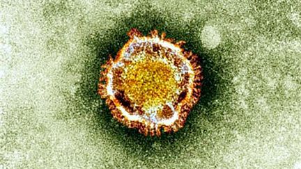 Photo non dat&eacute;e du nouveau coronavirus observ&eacute; au microscope &eacute;lectronique, distribu&eacute;e par l'agence britannique de protection de la sant&eacute;. (BRITISH HEALTH PROTECTION AGENCY / AFP)