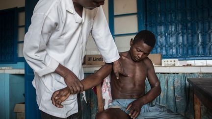 En 2006, l’Organisation mondiale de la santé (OMS), avait annoncé que la lèpre n’était plus un problème de santé publique mondial. Ce qui avait eu des conséquences dramatiques sur la mobilisation de l’opinion publique. Les dons des particuliers, indispensables pour mener à bien l’éradication de cette maladie d’un autre âge, avaient alors chuté. Mais en 2016, l’OMS rectifie son annonce malencontreuse et adopte une nouvelle "Stratégie mondiale de la lutte contre la lèpre 2016-2020". A Madagascar, on voit apparaître, chaque année, 1.500 à 2.000 nouveaux cas. (CORENTIN FOHLEN / FONDATION RAOUL FOLLEREAU)