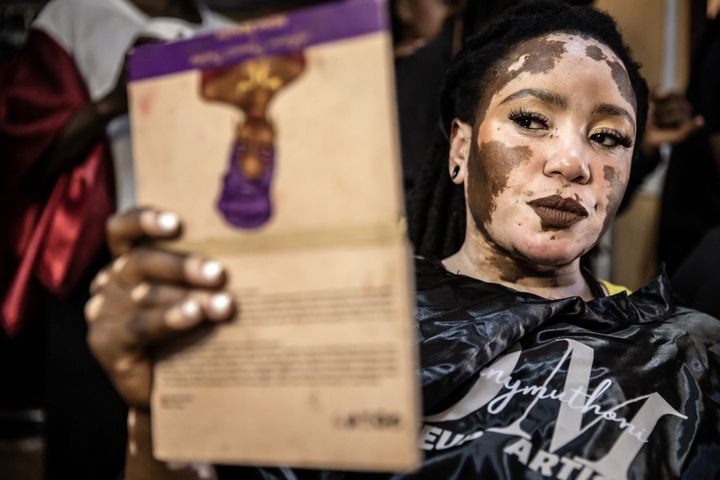 Julie Nasuju, mannequin vitiligo, avant le principal défilé de mode de la Kibera Fashion Week, le 15 octobre 2023. (LUIS TATO / AFP)