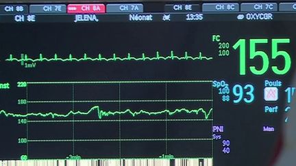 Covid-19 : des enfants atteints du syndrome de Kawasaki, un cas mortel