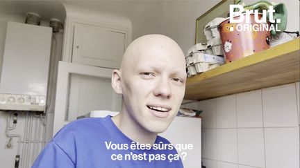 VIDEO. David se confie sans détour sur son alopécie (BRUT)