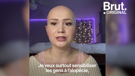 Hayden, 18 ans, est atteinte d'alopécie. Et l'alopécie, c'est ça.