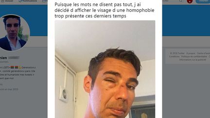 Damien a montré sur Twitter ses blessures après son agression, le samedi 18 août 2018. (CAPTURE D'ECRAN TWITTER)