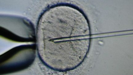 Injection&nbsp;de spermatozoïde dans un ovocyte à l'aide d'une micro-pipette en vue d'une fécondation in vitro, au centre hospitalier d'Amiens (Somme), le 6 novembre 2011.&nbsp; (MAXPPP)