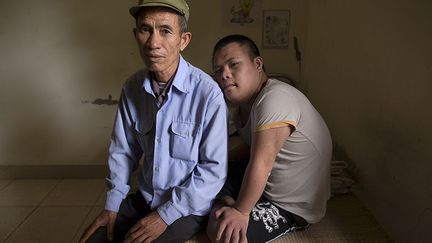 Il vient rendre visite à son fils Nguyen Dinh Loc, 20 ans, dans le Village de l'amitié, un hospice pour les victimes de l'agent orange créé en 1998 près de Hanoi. Son fils vient d’être opéré d’une tumeur. Il souffre de graves problèmes mentaux et physiques. Nguyen Hong Phuc n’a rejoint l'armée qu’en 1971 quand l'armée américaine avait déjà cessé d'utiliser l'agent orange. Mais vivant dans des zones fortement contaminées, il a été empoisonné.  (REUTERS/Damir Sagolj )