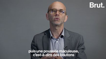 “Il est moins dangereux”. “Le virus est présent en Afrique”... Olivier Schwartz, directeur de l’Unité Virus et Immunité de l’Institut Pasteur, répond à 7 questions très simples sur la variole du singe. (BRUT / FRANCEINFO)