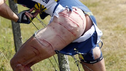 La cuisse du coureur cycliste Johnny Hoogerland apr&egrave;s sa chute, lors de la 9e &eacute;tape du Tour de France, pouss&eacute; par une voiture suiveuse, le 10 juillet 2011.&nbsp; (REUTERS)