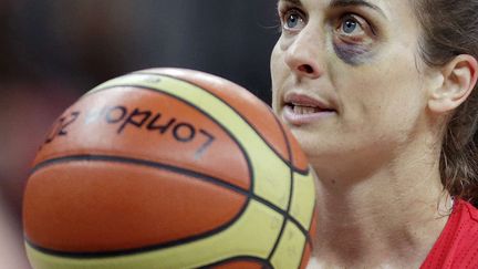 La basketeuse Natalie Stafford arbore un &oelig;il au beurre noir lors du match contre le Canada le lundi 30 Juillet 2012 aux JO de Londres.&nbsp; (CHARLES KRUPA / SIPA)