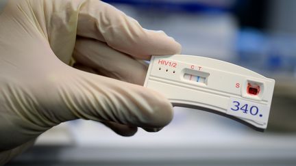 Un test de dépistage rapide du HIV, à Berlin, en 2016. (BRITTA PEDERSEN / ZB / AFP)