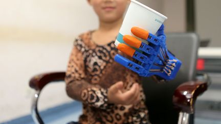 Maxence, 6 ans, va recevoir une prothèse de main imprimée en 3D