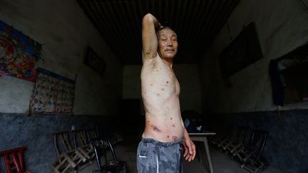 En avril 2014, une étude d’Health Effect Institut estimait ainsi que 1,2 million de Chinois étaient morts prématurément dans tout le pays en 2010 en raison de sa mauvaise qualité. Soit près de 40% du total mondial des morts prématurées dues à la pollution ! (REUTERS / Jason Lee)