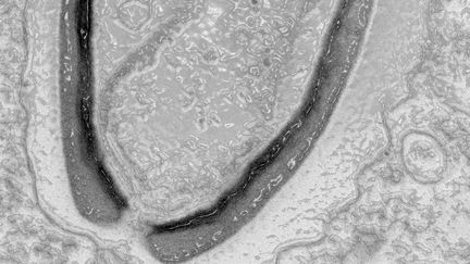 Un pandoravirus vu au microscope électronique. Photo d'illustration. (HANDOUT / IGS-CNRS)