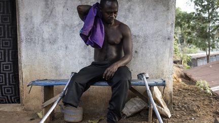 &nbsp; De 1991 à 2002, la guerre civile en Sierra Leone a fait des dizaines de morts et laissé beaucoup de personnes meurtries dans leur chair. Aujourd’hui âgé de 37 ans, Sheku Turay avait 12 ans quand son village du district de Tonkolili a été attaqué par des rebelles. Blessé à une jambe, il a dû être amputé pour être sauvé de la gangrène. (JOHN WESSELS / AFP)