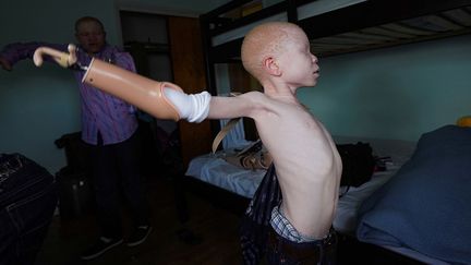 Victimes de sorcellerie, des enfants albinos mutilés sont "réparés" à New York (CARLO ALLEGRI /REUTERS)