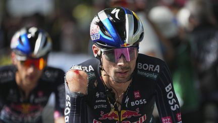 Primoz Roglic passant la ligne d'arrivée après sa chute dans le dernier kilomètre de l'étape 12 du Tour de France, le 11 juillet 2024. (DANIEL COLE/SIPA)