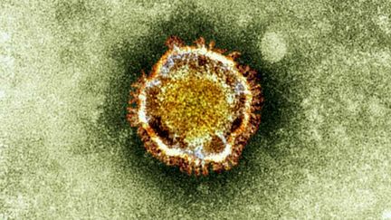 Vue au microscope d'un coronavirus proche du SRAS. Un premier cas a &eacute;t&eacute; d&eacute;tect&eacute; en France, le 8 mai 2013. (AP / SIPA)