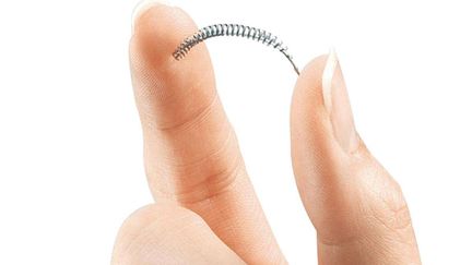 Un implant contraceptif définitif Essure. 21 septembre 2015. (UNCREDITED/AP/SIPA / AP)