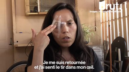 1015 personnes ont été blessées par des impacts de balles. L'ONG Human Rights Watch lance l'alerte.