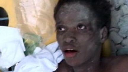 La jeune miraculée de 16 ans sauvée des décombres de Port-au-Prince le 18 janvier, 15 jours après le séisme. (France 2)