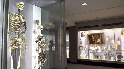 Le squelette de Charles Byrne, dit le "géant irlandais" (2m30), mort en 1783 âgé de 22 ans, exposé au Hunterian museum de Londres (2011). (AP/SIPA / AP)