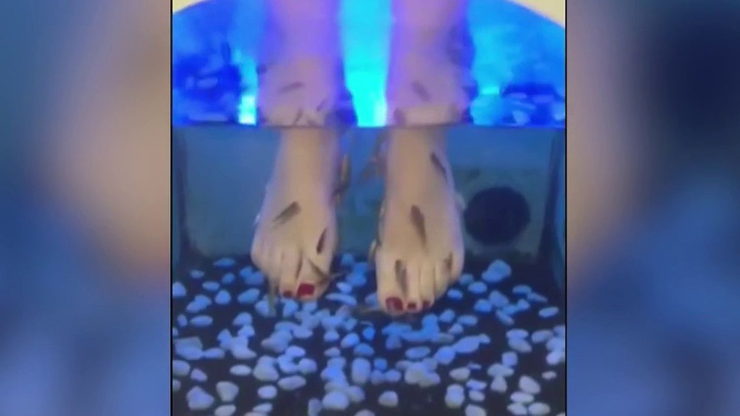 Does the “fish pedicure” present any risks?