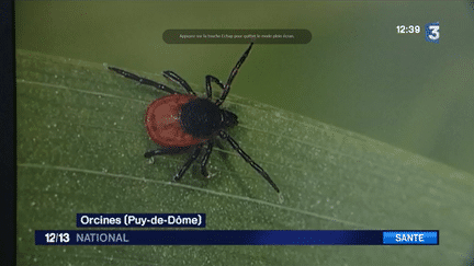 Santé : alerte aux tiques qui transmettent la maladie de Lyme