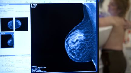 Une femme passe une mammographie &agrave; l'h&ocirc;pital des Diaconesses, &agrave; Paris, le 28 mai 2009. (AMELIE BENOIST / BSIP)