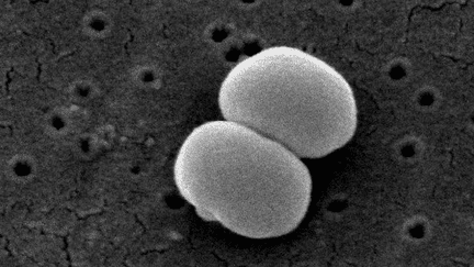 Le staphylocoque epidermidis en microscopie électronique (&copy; Janice Carr Content )